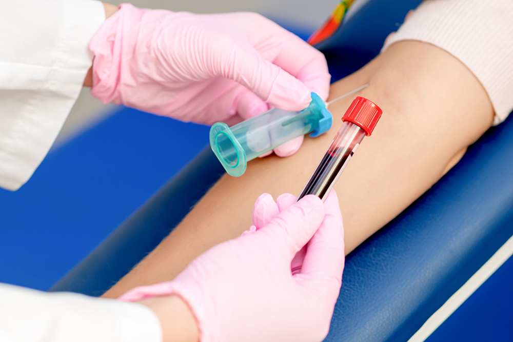 Coleta de sangue para exames preventivos relacionados à saúde do fígado.